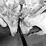 cut breast cartilage