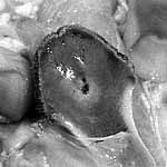 pop out keel bone