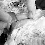 remove keel bone