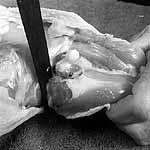 cut through hip joint